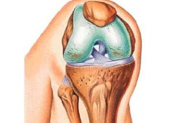 The main causes of knee osteoarthritis