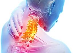 Symptoms of neck osteochondrosis and nutritional rules for diseases