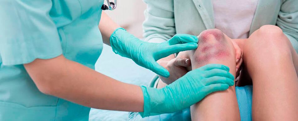 A doctor examines a knee injury