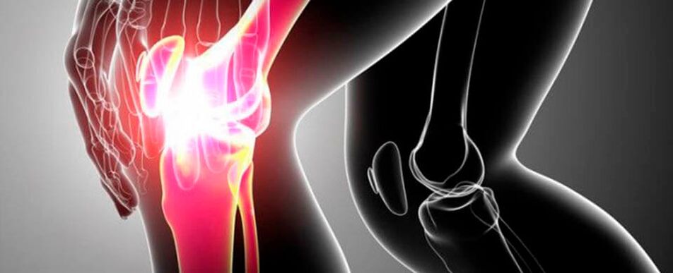 Pain in the knee joint photo 4