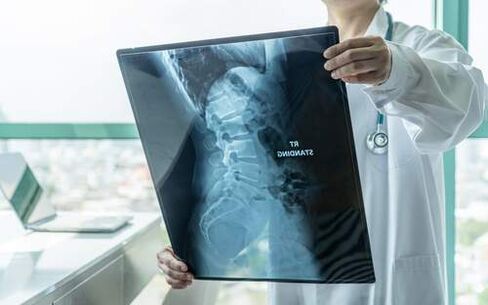 X-ray is a necessary diagnostic method when the back hurts